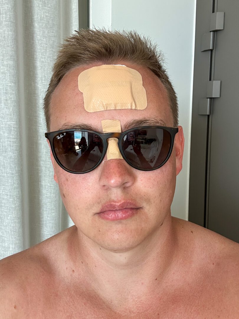 Hotel guest wearing sunglasses with forehead bandages after a poolside accident.